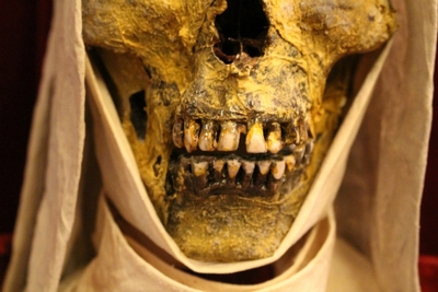 Unique Reliquary Of Blessed Nun / Exhumed Mummified Skull Dressed With Her Original Head - Cover Belgium 18th century